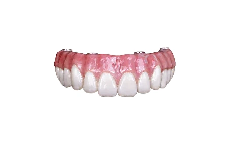 Несъёмный временный протез